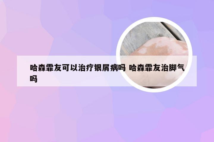 哈森霏友可以治疗银屑病吗 哈森霏友治脚气吗