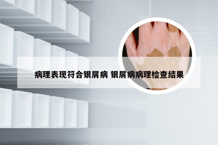 病理表现符合银屑病 银屑病病理检查结果