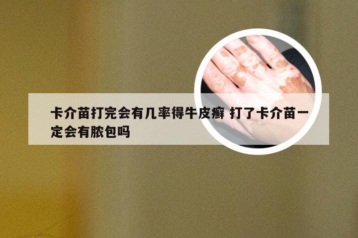 卡介苗打完会有几率得牛皮癣 打了卡介苗一定会有脓包吗