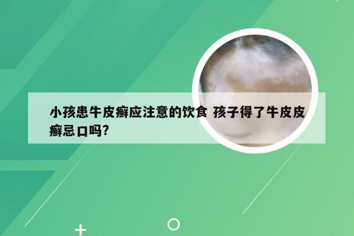 小孩患牛皮癣应注意的饮食 孩子得了牛皮皮癣忌口吗?