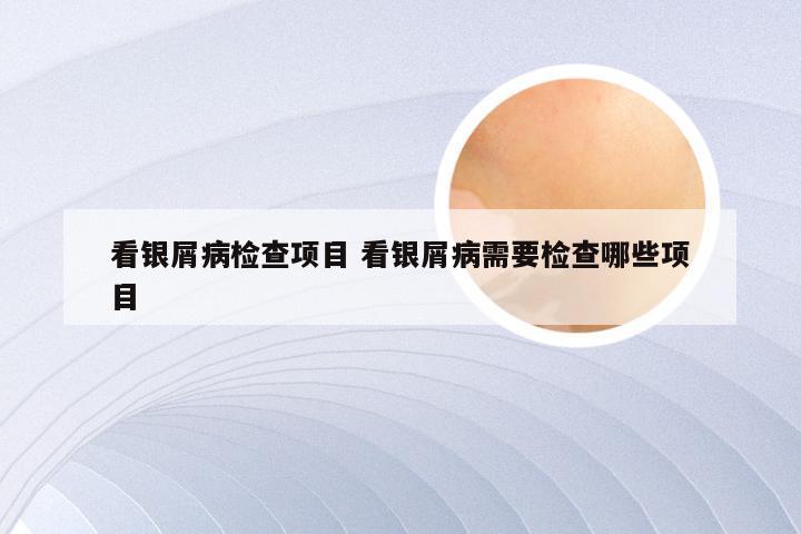 看银屑病检查项目 看银屑病需要检查哪些项目