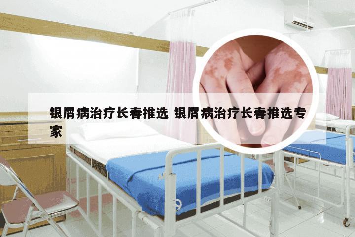 银屑病治疗长春推选 银屑病治疗长春推选专家