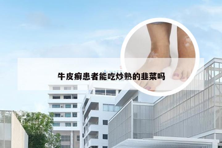 牛皮癣患者能吃炒熟的韭菜吗
