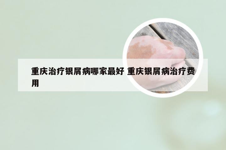重庆治疗银屑病哪家最好 重庆银屑病治疗费用