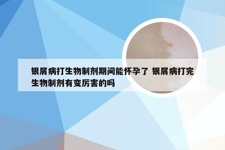 银屑病打生物制剂期间能怀孕了 银屑病打完生物制剂有变厉害的吗