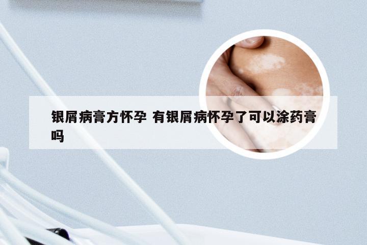 银屑病膏方怀孕 有银屑病怀孕了可以涂药膏吗