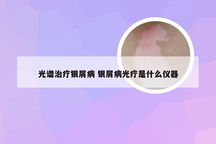 光谱治疗银屑病 银屑病光疗是什么仪器