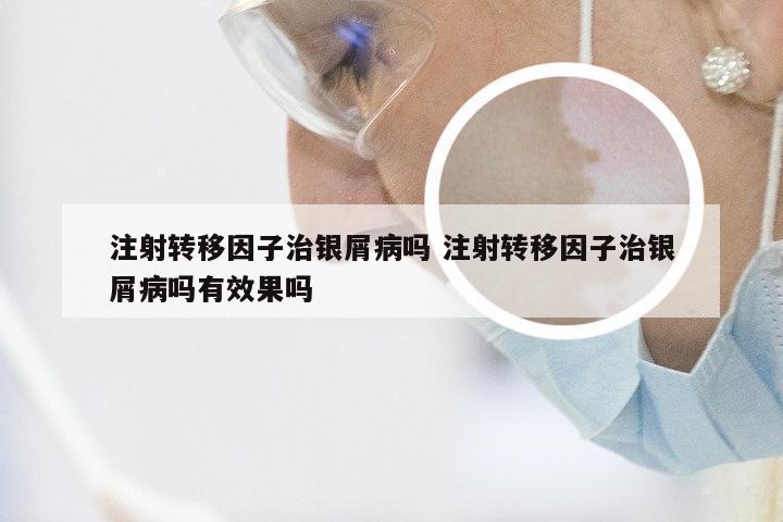 注射转移因子治银屑病吗 注射转移因子治银屑病吗有效果吗