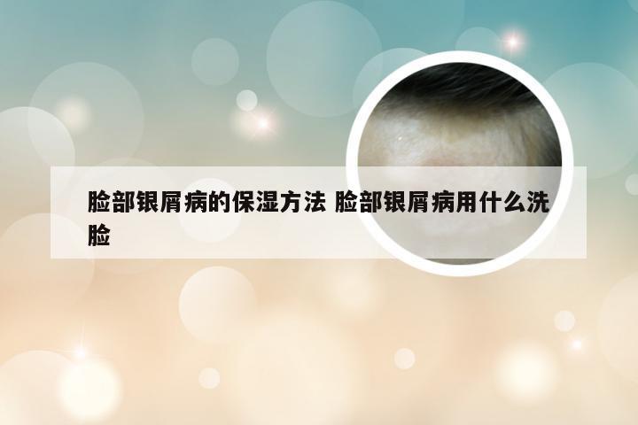脸部银屑病的保湿方法 脸部银屑病用什么洗脸