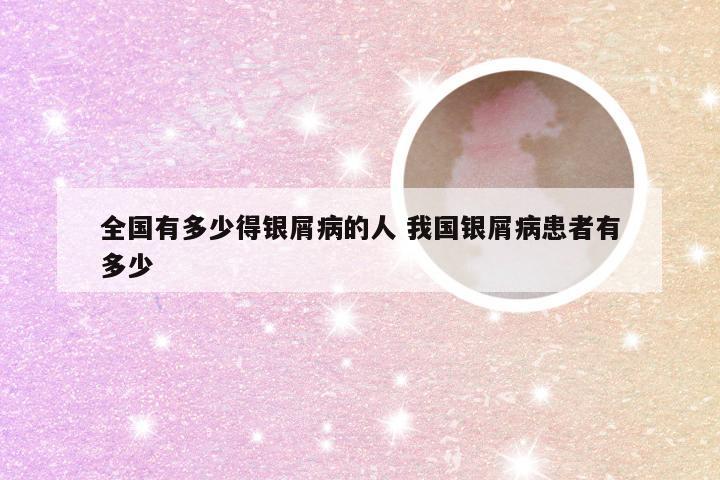 全国有多少得银屑病的人 我国银屑病患者有多少