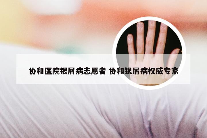 协和医院银屑病志愿者 协和银屑病权威专家