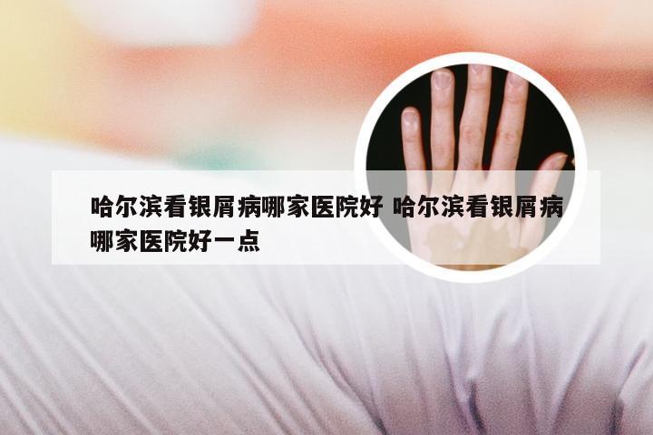 哈尔滨看银屑病哪家医院好 哈尔滨看银屑病哪家医院好一点