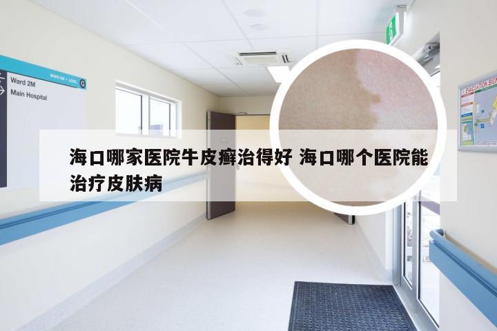 海口哪家医院牛皮癣治得好 海口哪个医院能治疗皮肤病