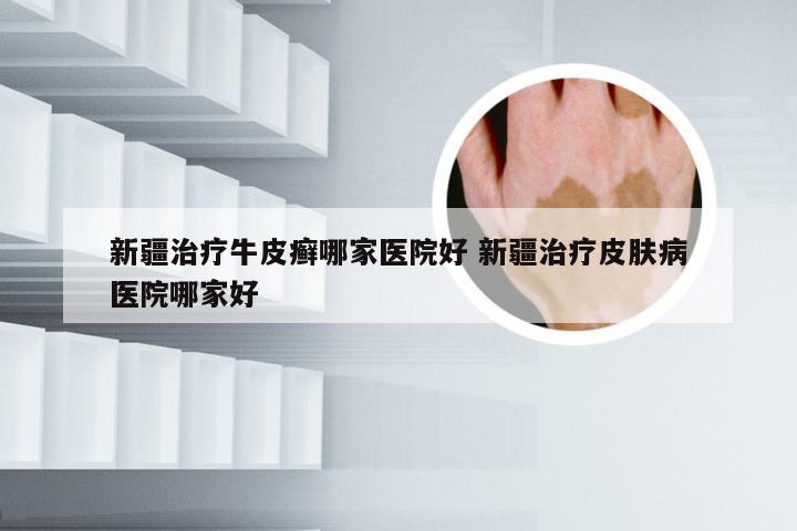 新疆治疗牛皮癣哪家医院好 新疆治疗皮肤病医院哪家好