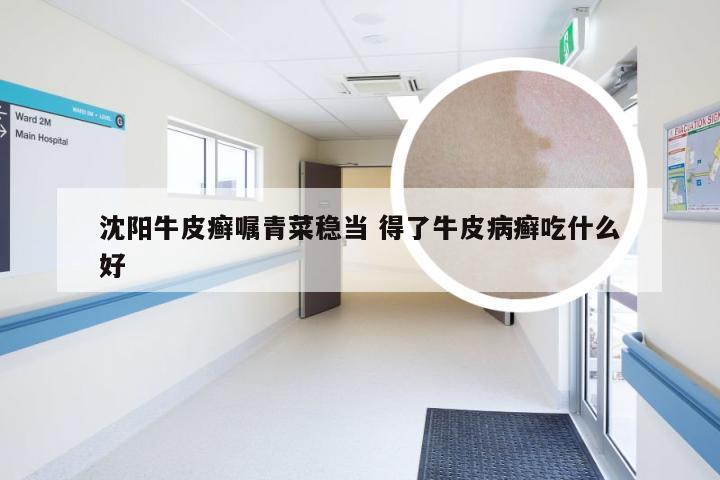 沈阳牛皮癣嘱青菜稳当 得了牛皮病癣吃什么好
