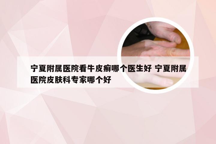 宁夏附属医院看牛皮癣哪个医生好 宁夏附属医院皮肤科专家哪个好