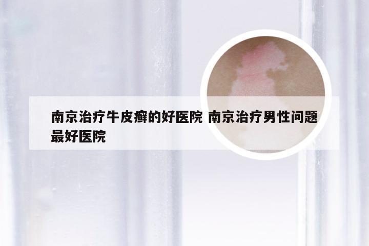 南京治疗牛皮癣的好医院 南京治疗男性问题最好医院