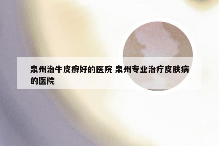 泉州治牛皮癣好的医院 泉州专业治疗皮肤病的医院