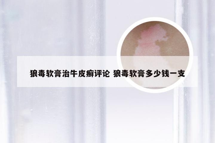 狼毒软膏治牛皮癣评论 狼毒软膏多少钱一支
