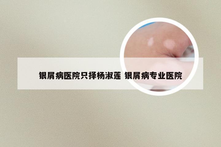 银屑病医院只择杨淑莲 银屑病专业医院