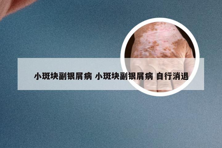 小斑块副银屑病 小斑块副银屑病 自行消退