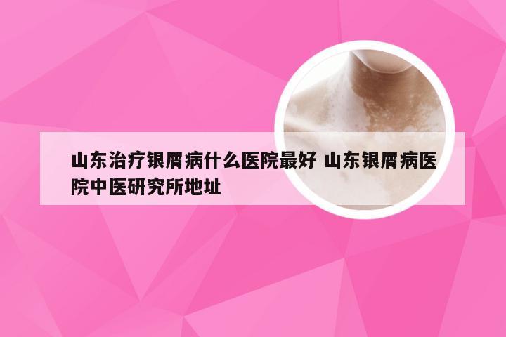 山东治疗银屑病什么医院最好 山东银屑病医院中医研究所地址