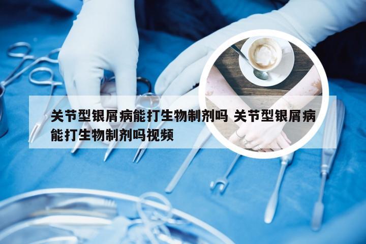 关节型银屑病能打生物制剂吗 关节型银屑病能打生物制剂吗视频