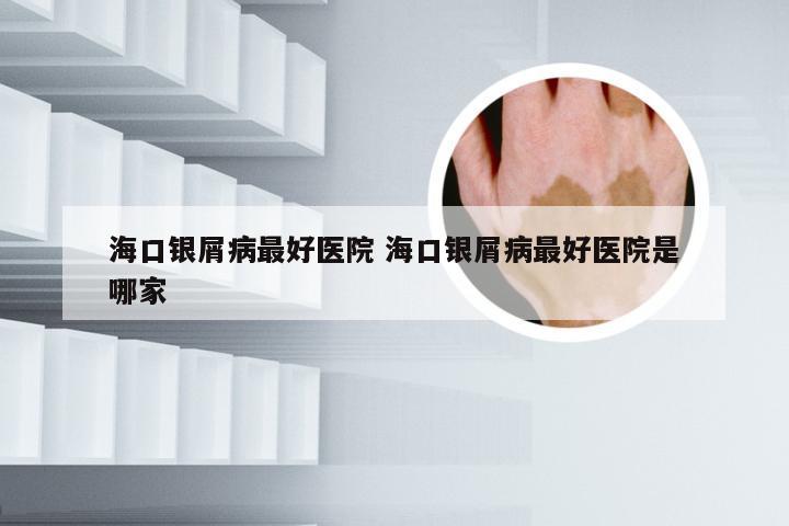 海口银屑病最好医院 海口银屑病最好医院是哪家
