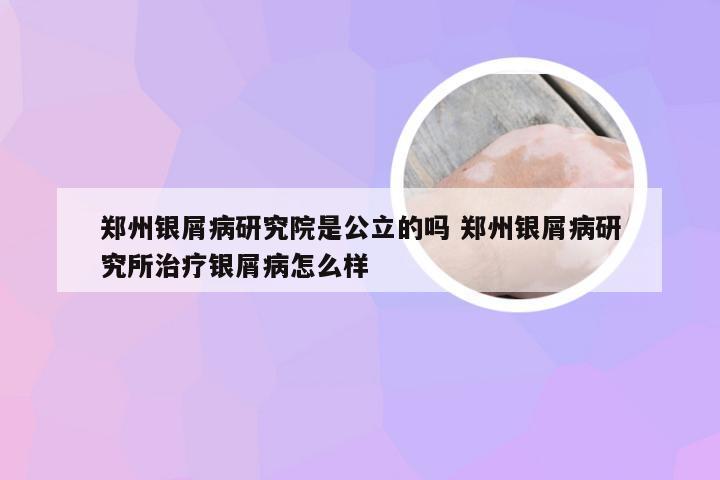 郑州银屑病研究院是公立的吗 郑州银屑病研究所治疗银屑病怎么样