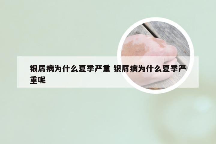 银屑病为什么夏季严重 银屑病为什么夏季严重呢