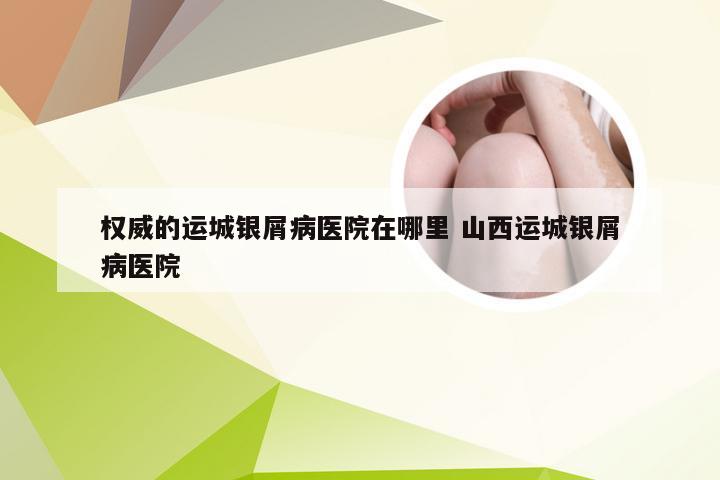 权威的运城银屑病医院在哪里 山西运城银屑病医院