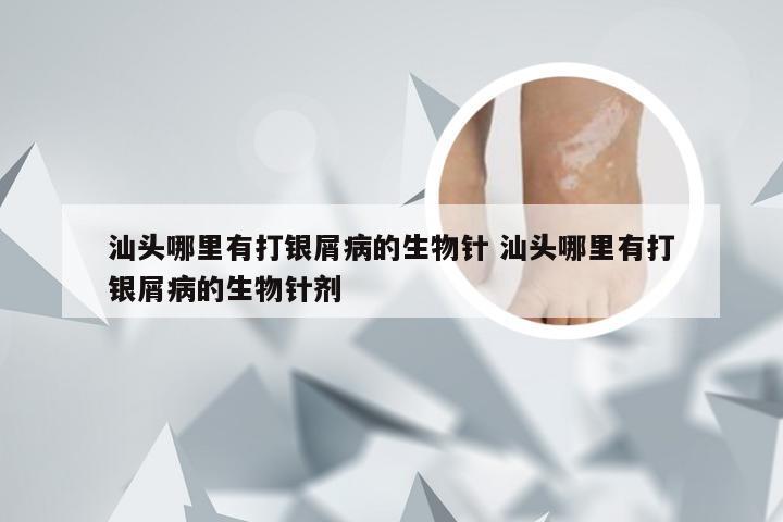 汕头哪里有打银屑病的生物针 汕头哪里有打银屑病的生物针剂