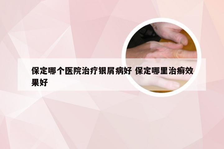 保定哪个医院治疗银屑病好 保定哪里治癣效果好