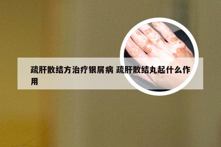 疏肝散结方治疗银屑病 疏肝散结丸起什么作用