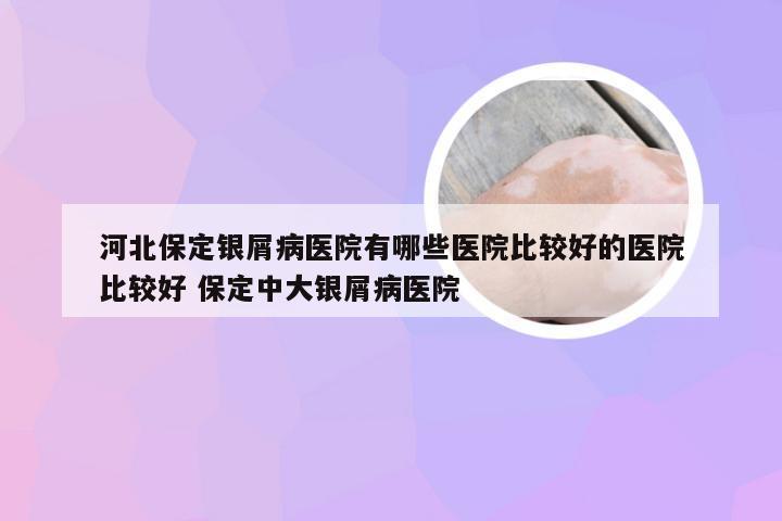 河北保定银屑病医院有哪些医院比较好的医院比较好 保定中大银屑病医院