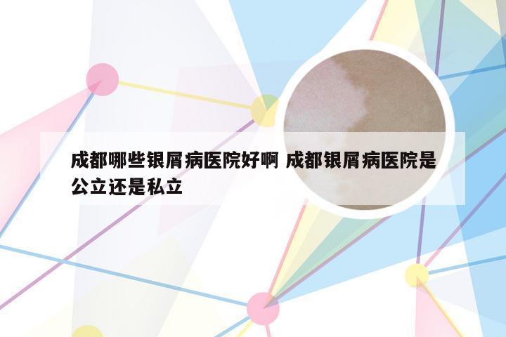 成都哪些银屑病医院好啊 成都银屑病医院是公立还是私立