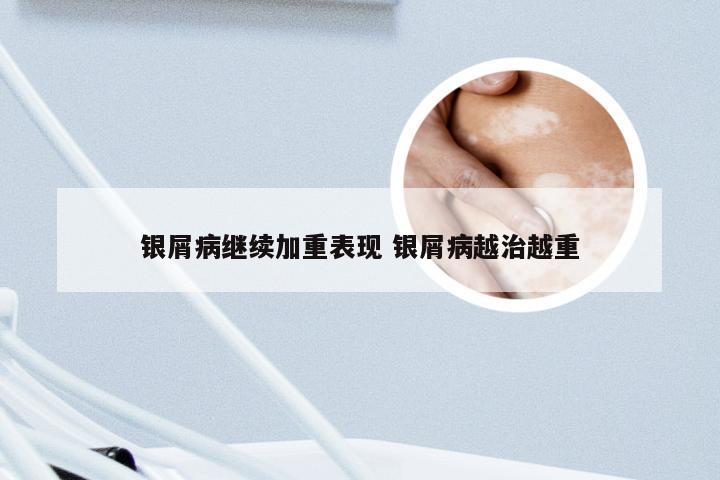 银屑病继续加重表现 银屑病越治越重