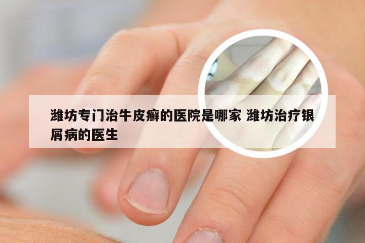 潍坊专门治牛皮癣的医院是哪家 潍坊治疗银屑病的医生