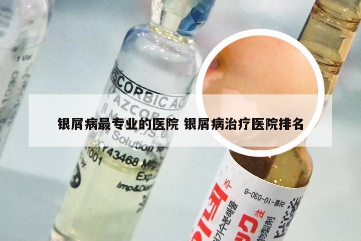 银屑病最专业的医院 银屑病治疗医院排名