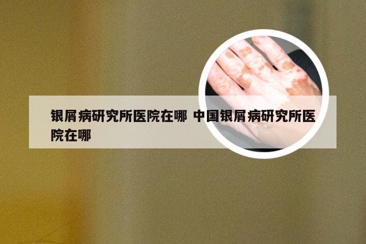 银屑病研究所医院在哪 中国银屑病研究所医院在哪