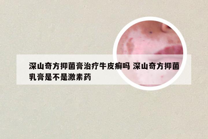 深山奇方抑菌膏治疗牛皮癣吗 深山奇方抑菌乳膏是不是激素药