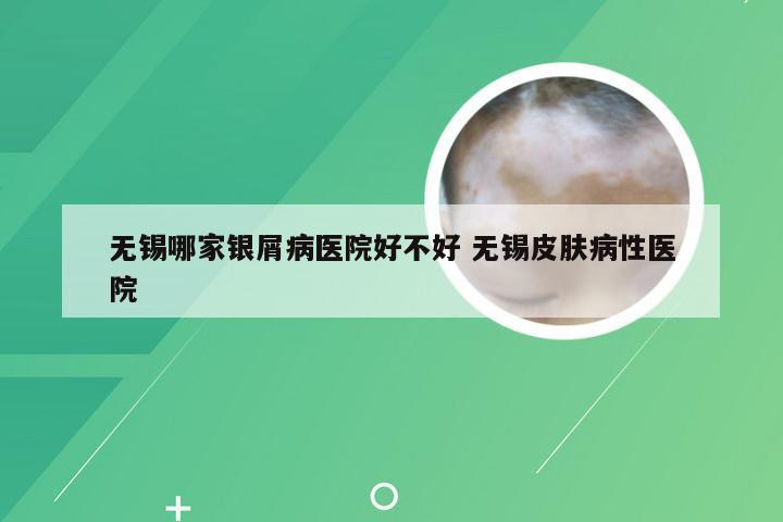 无锡哪家银屑病医院好不好 无锡皮肤病性医院
