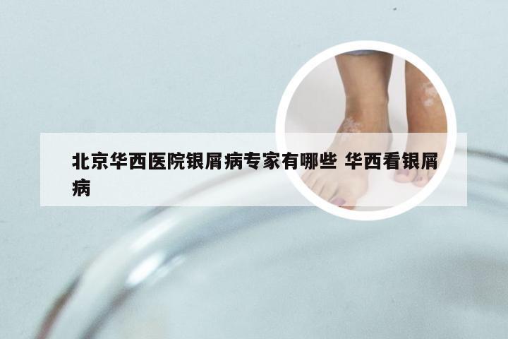 北京华西医院银屑病专家有哪些 华西看银屑病