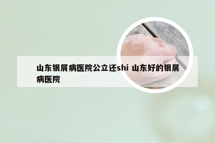 山东银屑病医院公立还shi 山东好的银屑病医院