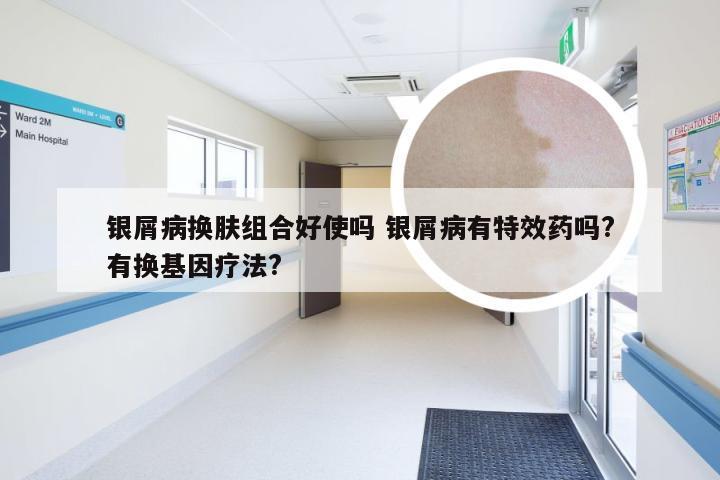 银屑病换肤组合好使吗 银屑病有特效药吗?有换基因疗法?
