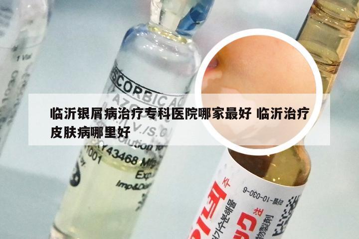 临沂银屑病治疗专科医院哪家最好 临沂治疗皮肤病哪里好