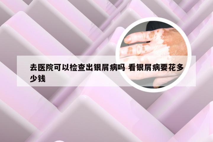 去医院可以检查出银屑病吗 看银屑病要花多少钱