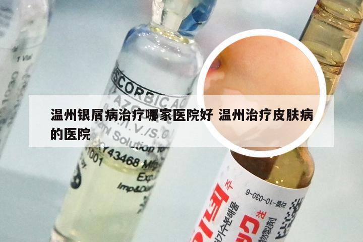 温州银屑病治疗哪家医院好 温州治疗皮肤病的医院