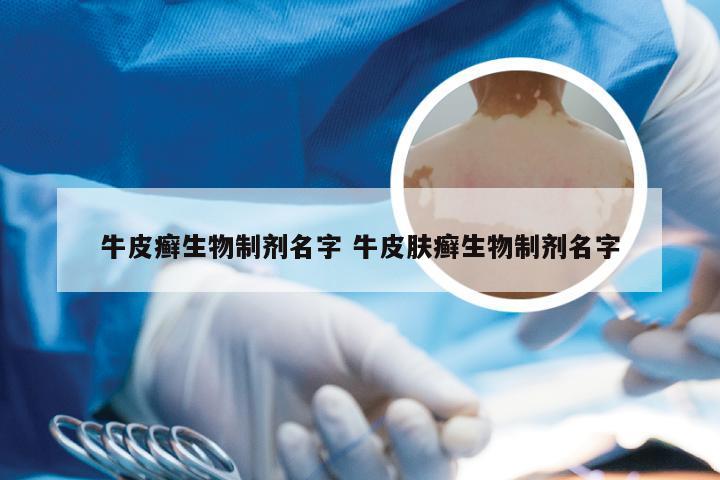 牛皮癣生物制剂名字 牛皮肤癣生物制剂名字