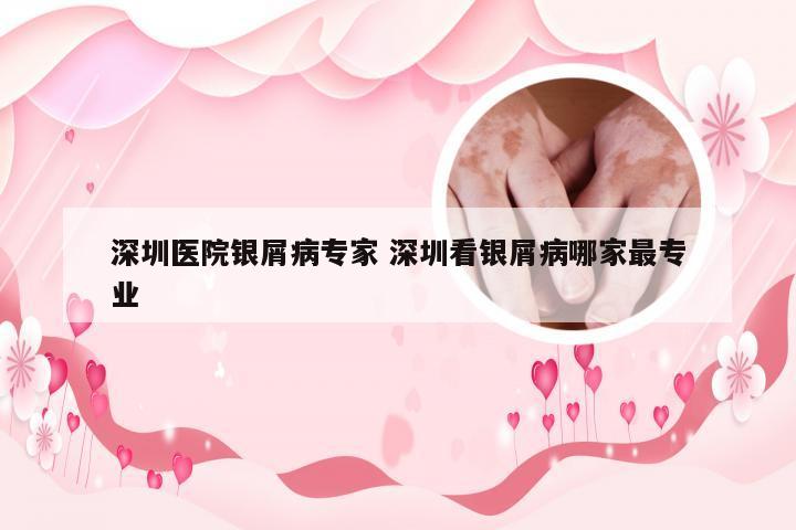 深圳医院银屑病专家 深圳看银屑病哪家最专业